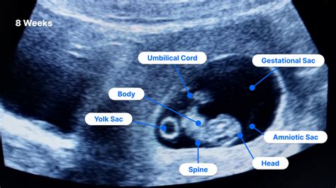 ulmf preg